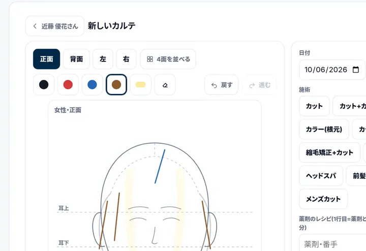 手書きのカルテの画面（デモ）