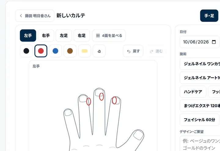 手と目もとの図のカルテの画面（デモ）