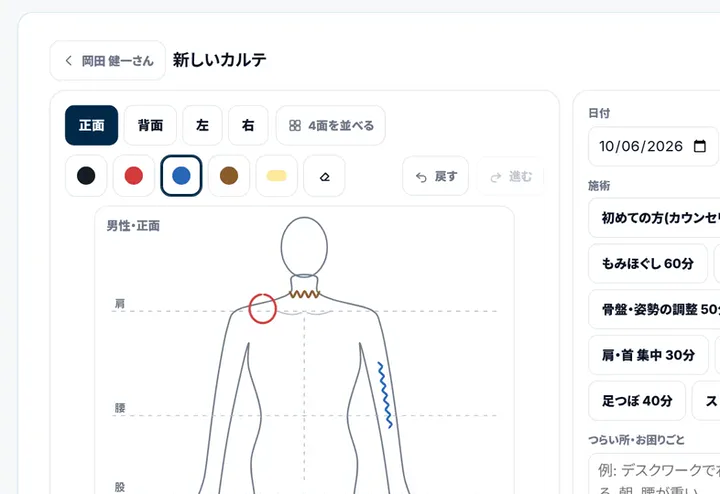 体の図のカルテの画面（デモ）